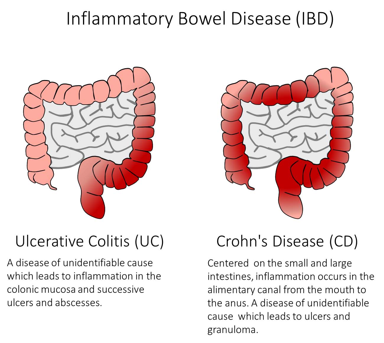 Potent New Mechanism Of Action For Treatment Of Inflammatory Bowel Disease Revealed University Of Tsukuba