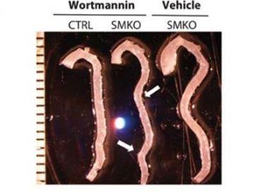 The involvement of PI3K in aortic aneurysm formation