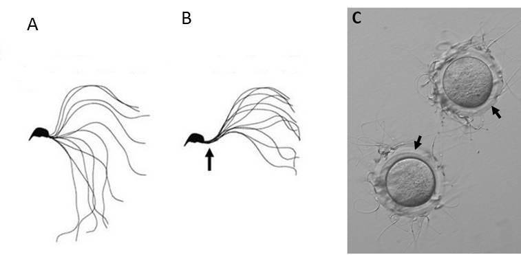 Spermatozoa motility