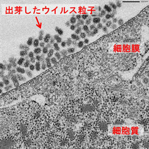 感染細胞の電子顕微鏡写真