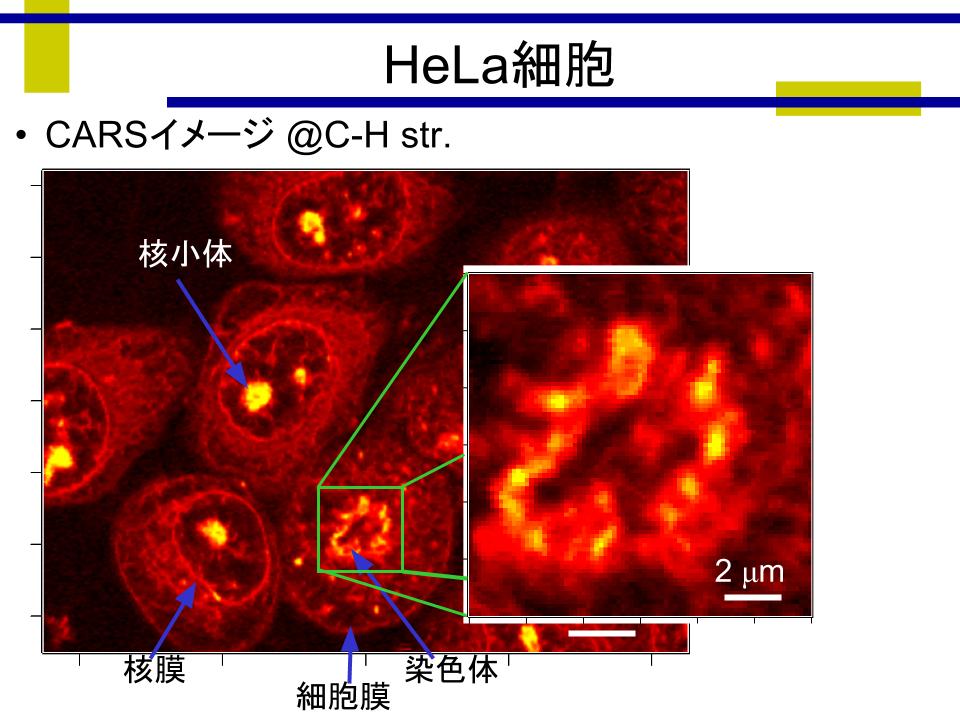 HeLa細胞の非線形ラマンイメージングの結果