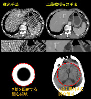 (対象となった研究成果の中から低被曝を実現する「スパースビューCT」と「インテリアCT」の画像再構成例(上段:通常の約1/40に相当する僅か40方向のスパースビューCT投影データからの腹部CT画像の再構成,下段:検査の関心領域のみにX線を照射したインテリアCT投影データからの頭部CT画像の再構成))